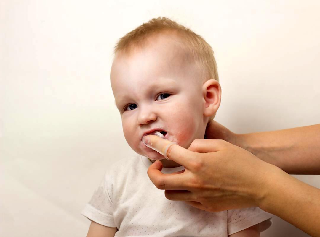 Preguntas más frecuentes en odontología para bebés