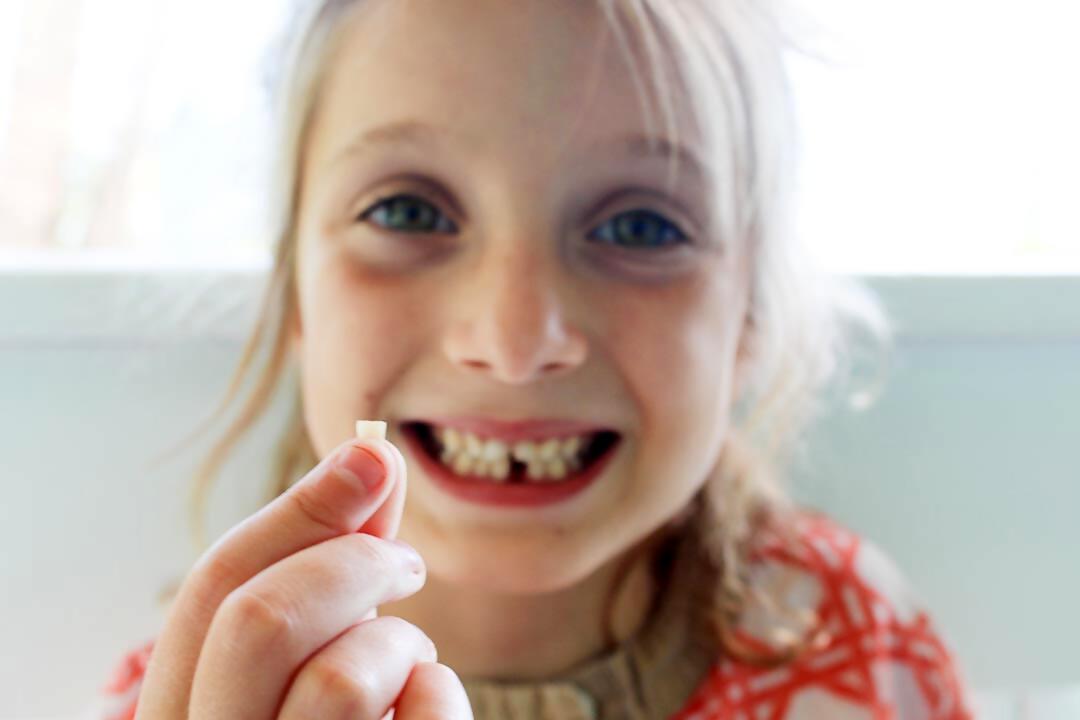 Dentición definitiva en niños