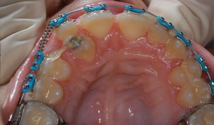 Ortodoncista infantil