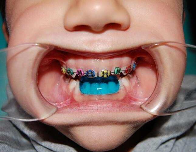 Ortodoncista infantil