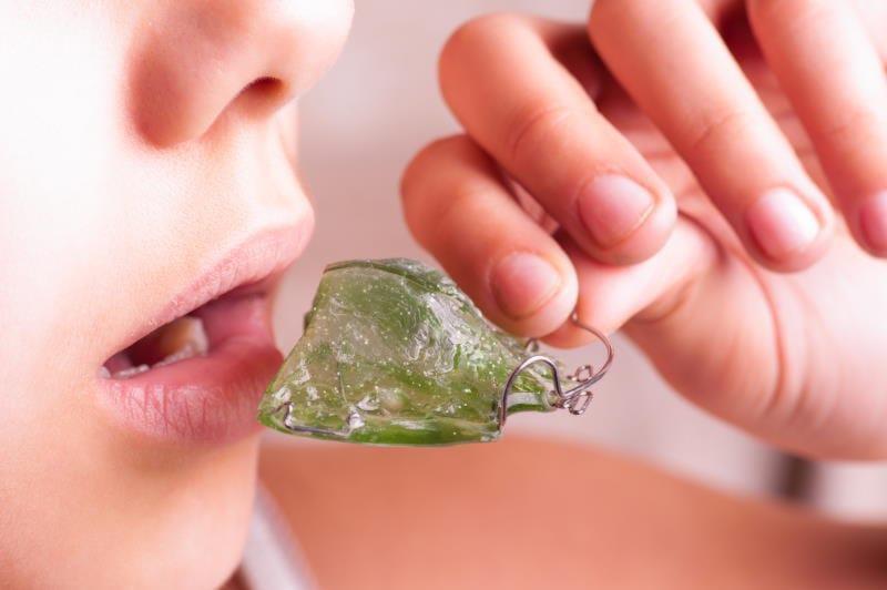 Aparatos Para Corregir Mandíbula | Clínica Dental Boj