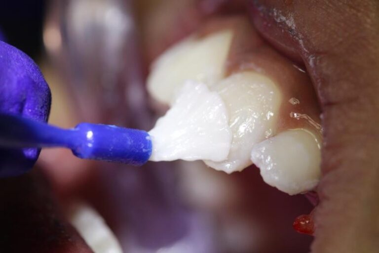 Neteja dental en bebès, nens i adolescents