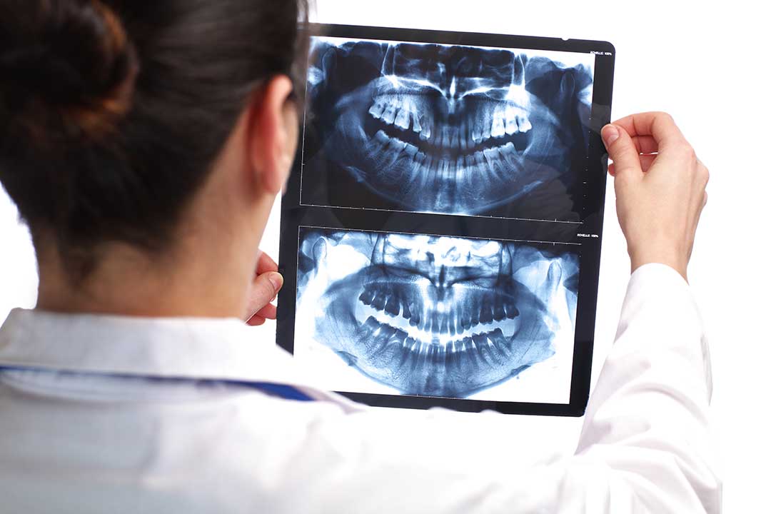¿Son seguras las radiografías dentales?