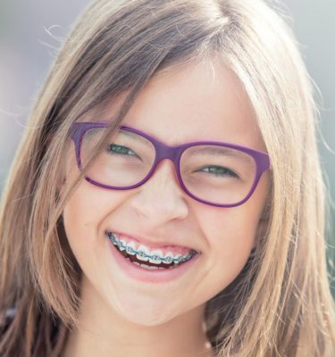 Brackets linguals per a jove Brackets linguals per a jove