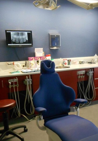 Extracción dental en niños